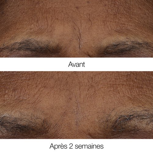 CLINIQUE-Smart Clinical Repair™ - Baume rétinoïde anti-rides CLINIQUE-Smart Clinical Repair™ - Baume rétinoïde anti-rides